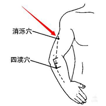 消爍穴|消疬穴